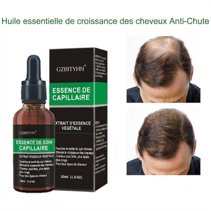 Huile Capillaire Réparatrice & Soin Global
