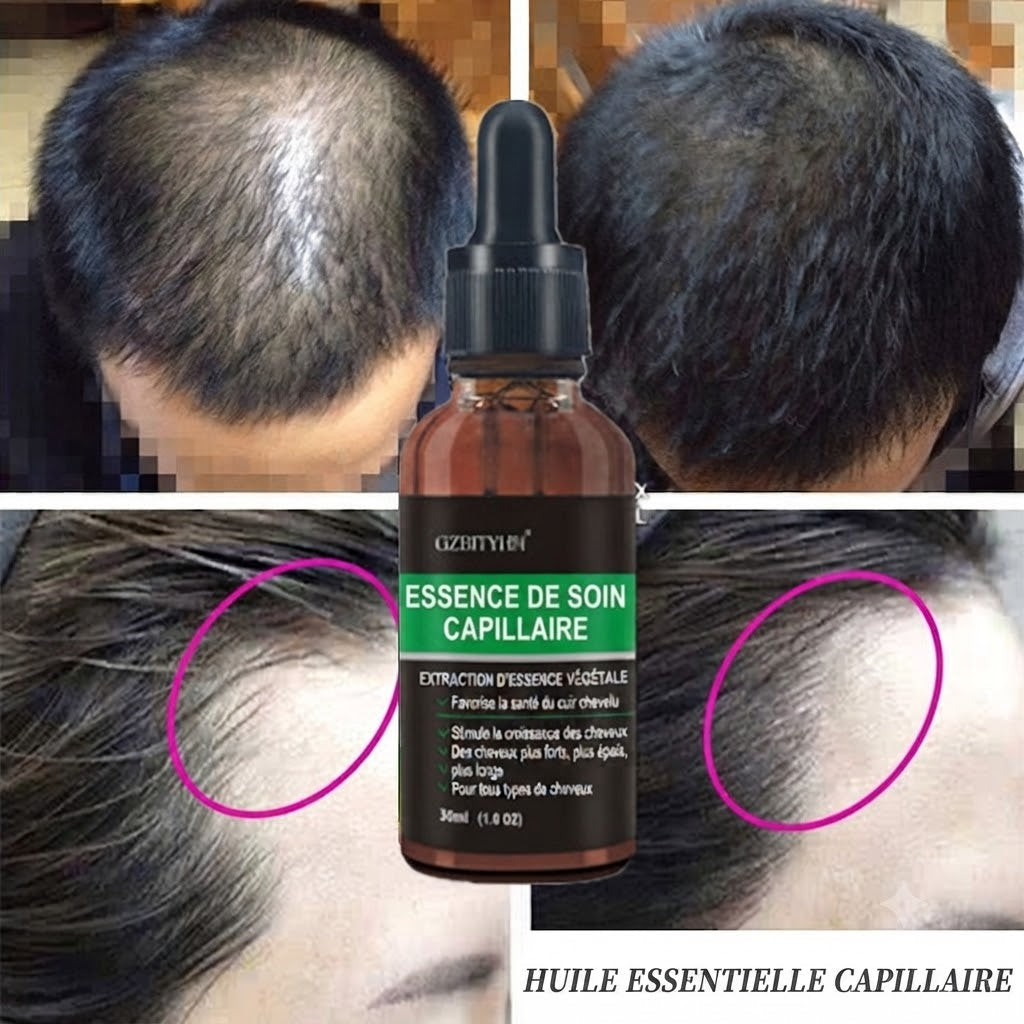 Huile Capillaire Réparatrice & Soin Global
