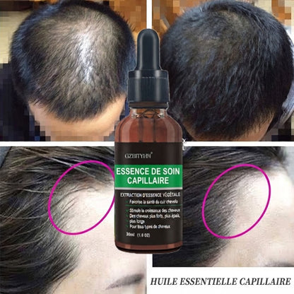 Huile Capillaire Réparatrice & Soin Global