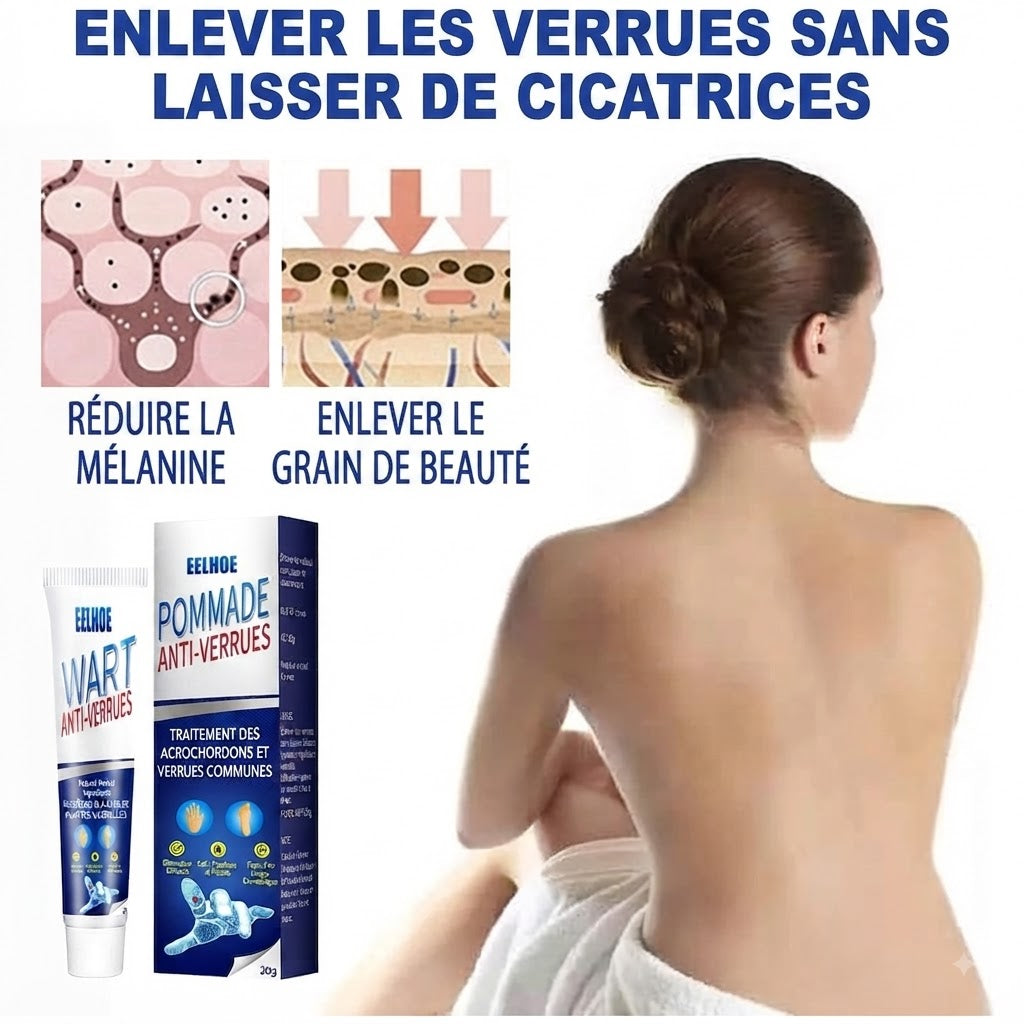 Crème Anti-Verrues & Soin Cutané