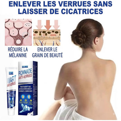 Crème Anti-Verrues & Soin Cutané