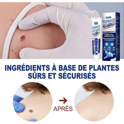Crème Anti-Verrues & Soin Cutané