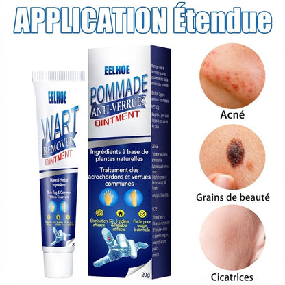 Crème Anti-Verrues & Soin Cutané