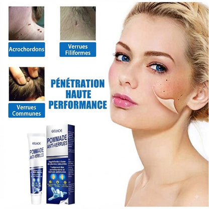 Crème Anti-Verrues & Soin Cutané